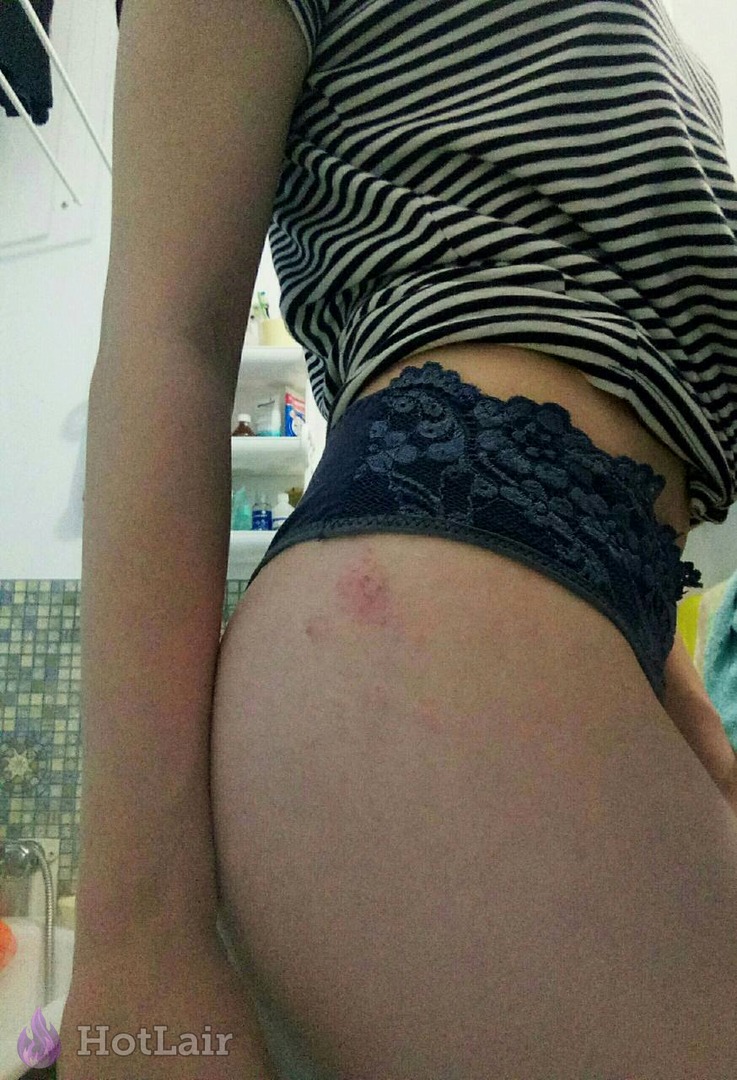 Close-up of girl’s hip and ass in striped shirt and dark blue lace panties